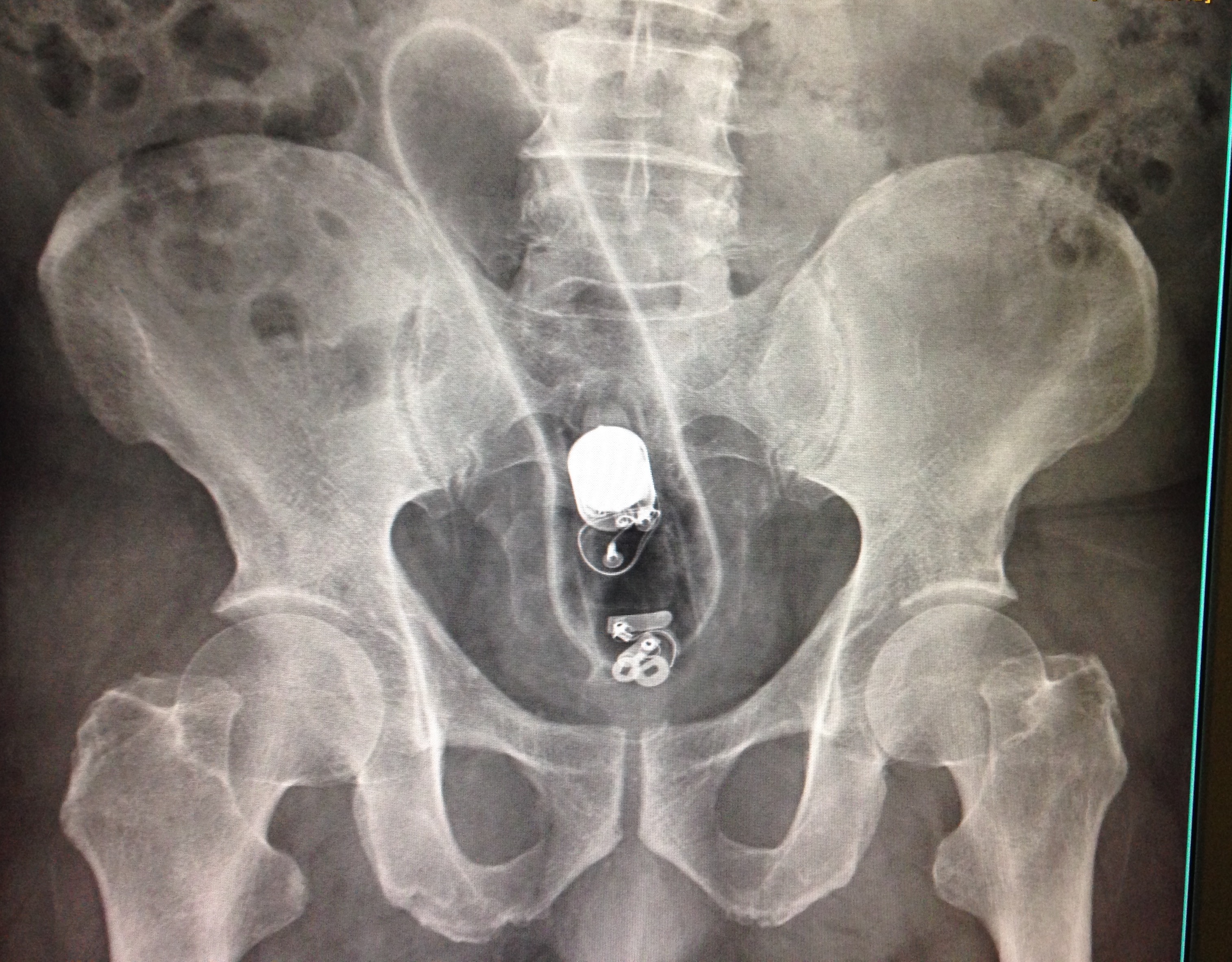Sex In Xray 56