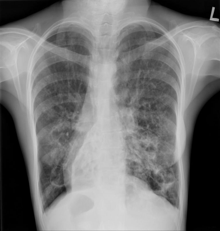 DEXTROCARDIA 3 | Buyxraysonline