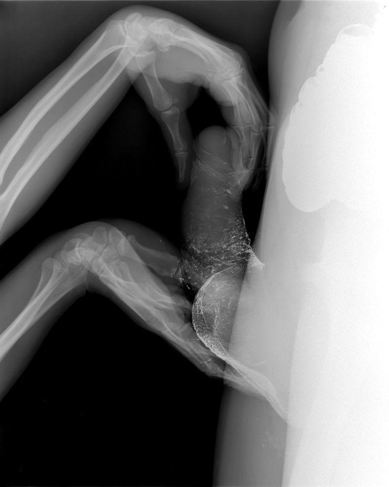 You can see tissue and bone much better in person when viewing these X-rays with the ...